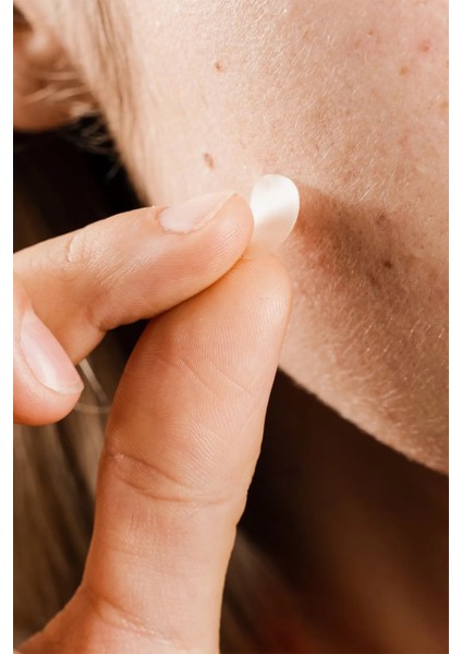 Kore Clear Spot Cure Patch Pimple Şeffaf Bant x 24 Adet