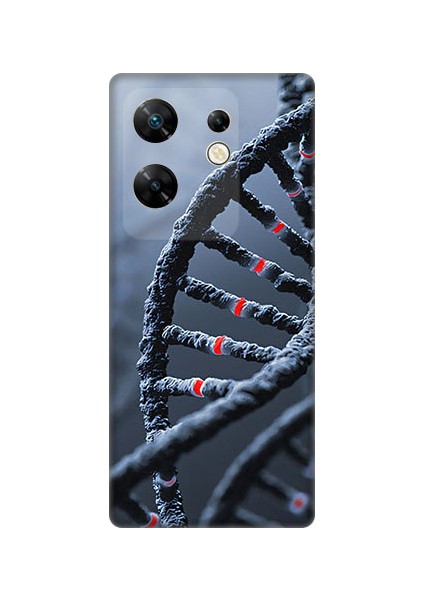 Infinix Zero 30 4g Uyumlu Dna Sarmalı Desenli Silikon Kılıf