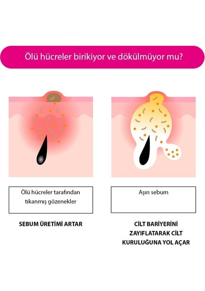 Kore Kozmetik Ekstra Nemlendirici Bariyer Blemish Krem