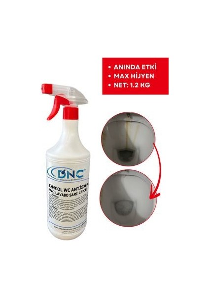 Wc Lavabo Temizleyici Sarı Leke Giderici -Ol Wc Antisarı
