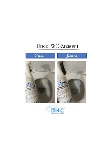 Wc Lavabo Temizleyici Sarı Leke Giderici -Ol Wc Antisarı