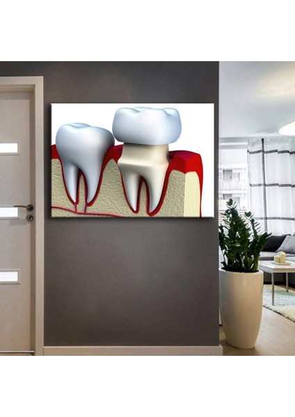 Ağız Ve Diş Sağlığı Polikliniği Tabloları Dekoratif Diş, Dsc-39