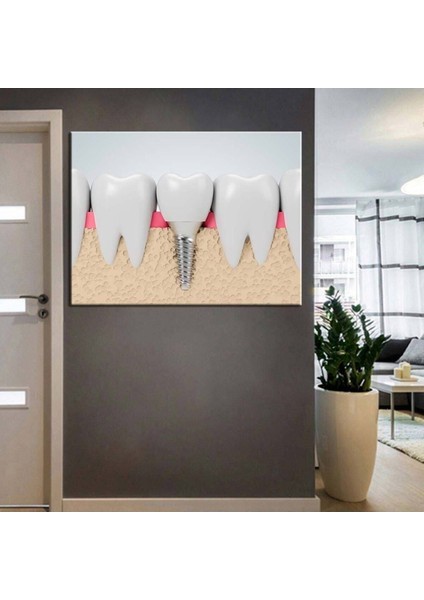 Ağız Ve Diş Sağlığı Polikliniği Tabloları Dekoratif Diş, Dsc-53