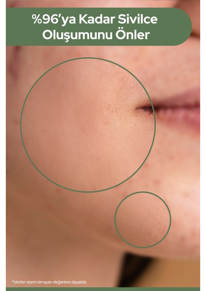 Çay Ağacı Yağı Özlü, Siyah Nokta Giderici, Sos Serum 10ML fırsatları