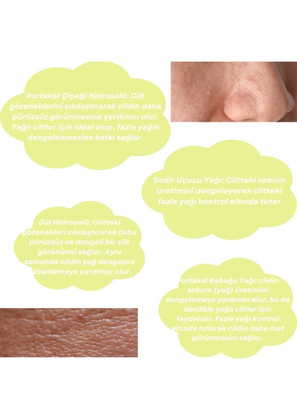 Skin Care Toner - Yağlı Ciltler Için Cilt Bakım Suyu modelleri