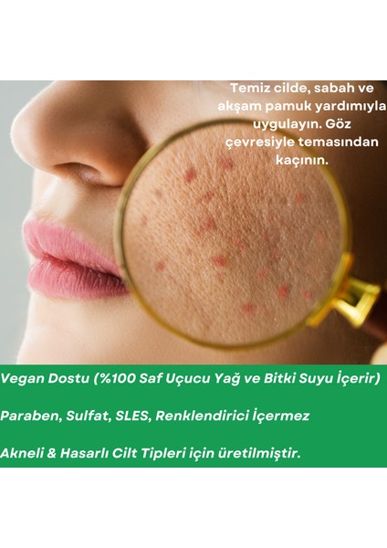 Antı-Acne Care Oıl Akne Karşıtı Cilt Bakım Yağı modelleri
