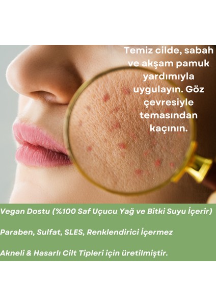Skin Care Toner - Akneli Ciltler Için Cilt Bakım Suyu fırsatları