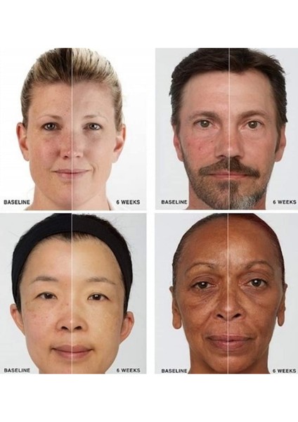 iderma Onarıcı, Yaşlanma Karşıtı ve Gençleştirici LED Maske