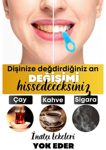 Diş Silgisi 1 Aparatlı + 5 Yedek Süngerli Set 1 Paket