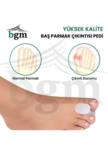 Baş Parmak Ayırıcı Silikon Makara Ped Halluks Valguss Baş Parmak Çıkıntısı Pedi