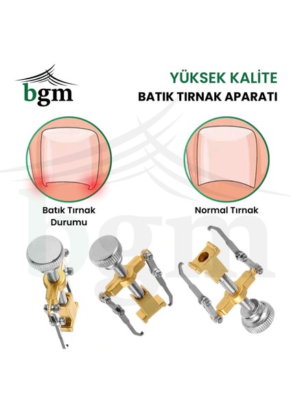 Batık Tırnak Çıkartıcı - Tırnak Aparatı fiyatları