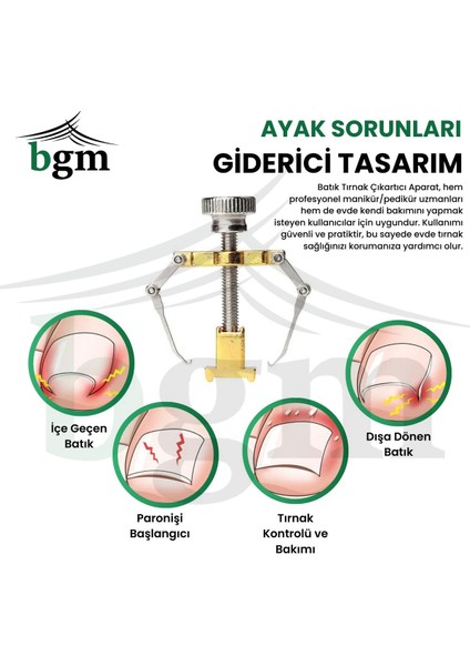 Batık Tırnak Çıkartıcı - Tırnak Aparatı fırsatları