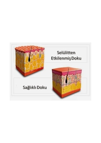 Hacamat Kupası 4 cm x 100 Adet + 1 Adet Vakum Pompası Hediyeli