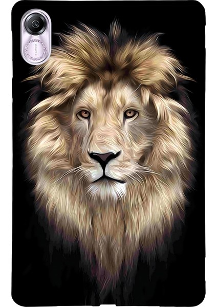 Honor Pad X8 Pro / X9 Için Boyalı Tpu Tablet Kılıfı (Yurt Dışından)