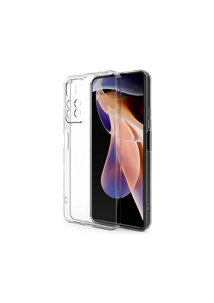 Redmi Note 11 Pro Plus 5g Kılıf Kamera Korumalı Şeffaf Onyx Tpu Süper Silikon Kapak
