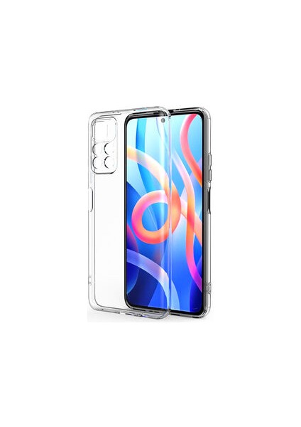 Redmi Note 11T 5g Kılıf Kamera Korumalı Şeffaf Onyx Tpu Süper Silikon Kapak