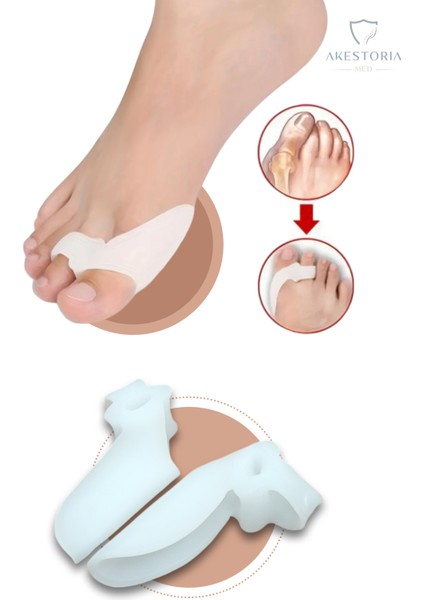 Çift İkili Parmak Bunyon Arası Makarlı Baş Parmak Silkonlu FC-008