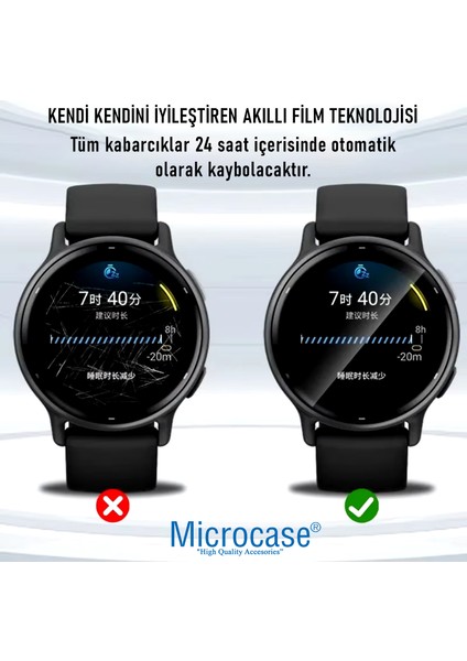Apple Watch Series 10 42MM Için Tpu Ekran Koruma Filmi - EKM109 indirimleri