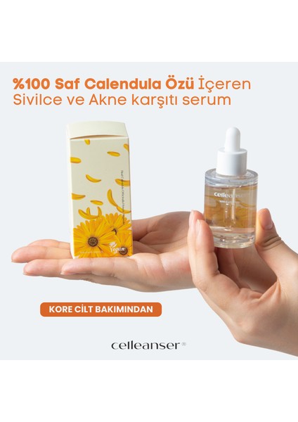 Calendula İçeren Sivilce Karşıtı Besleyici, Yatıştırıcı Serum