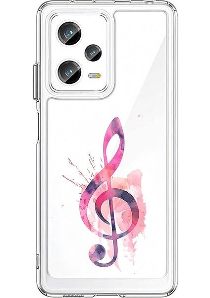 Xiaomi Redmi Note 12 Pro Plus Uyumlu Müzik Notası Desenli Silikon Kılıf