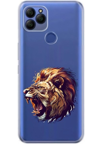 General Mobile Gm 21 Uyumlu Xxxxxxxx Desenli Silikon Kılıf