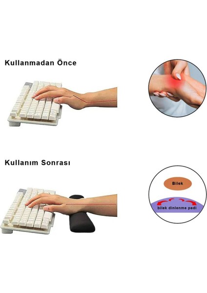 Bilek Destekli Klavye Pad - Kaymaz Klavye Destek Pedi - Keyboard Pedi - Oval Klavye Pedi - Klavye Desteği ( 1 Adet )