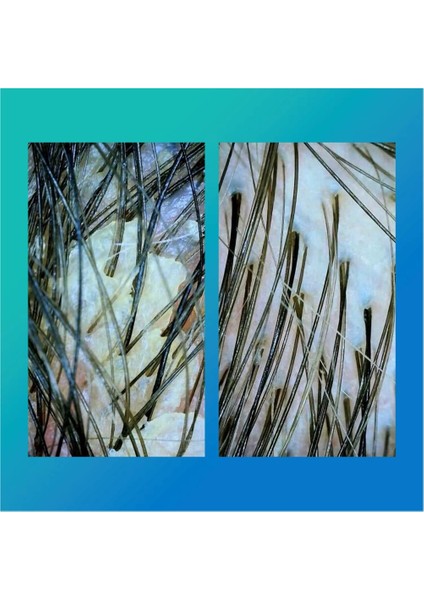 Peptıde Prep Detox Shampoo - Şampuan 250 ml fiyatları