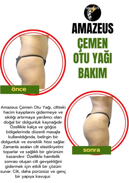 Çemen Otu Yağı (%100 Saf ve Doğal) Besleyici Etki 20 ml / 0.7 Fl Oz fırsatları