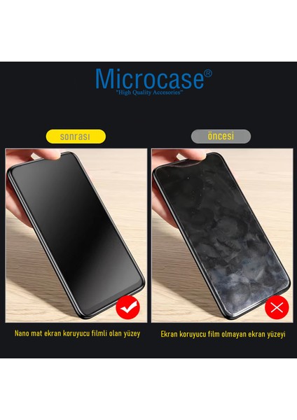 Honor Magic 7 Pro ile Uyumlu Tpu Nano Mat Ekran Koruma Filmi EKM107