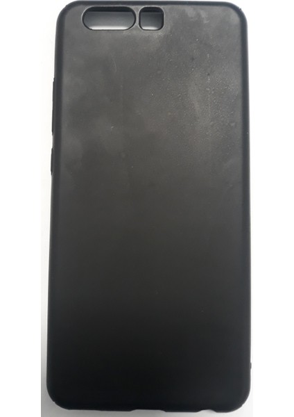 Huaweı P10 Sert Plastik Kılıf