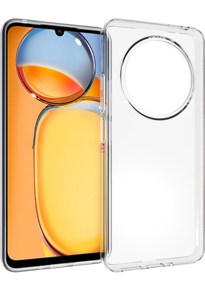 Xiaomi Redmi 14C 4g Şeffaf Telefon Kılıfı Filigrana Dayanıklı Tpu Arka Kapak Için (Yurt Dışından)