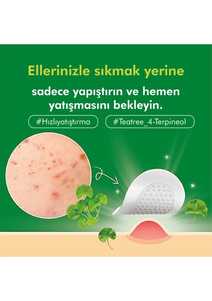 2'li Micro Point Patch Mikro Iğneli Teknolojiyle Kore Üretimi Çay Ağacı Özlü Bandı 9*2'li