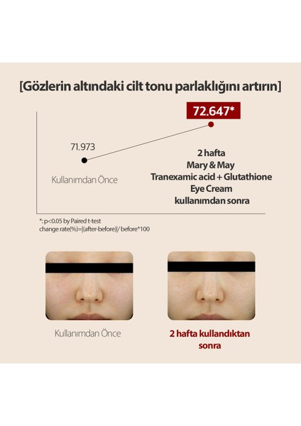 Tranexamic Acid+Glutathion Koyu Halka Karşıtı Aydınlatıcı Göz Çevresi Kremi 30 ml