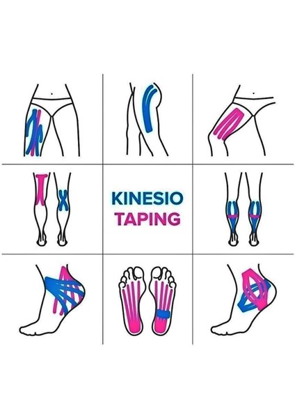 Kinesio Sporcu Bandı - Kinesiotape Bantlama - Sakatlık Bandı - Kinesio Bant - Kinezyo Bant - Kinesiotape 5CMX5M.