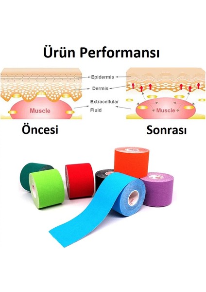 AC-150 Yüz & Vücut Uyumlu Hipoalerjenik Kinesio Tape 5m x 5cm