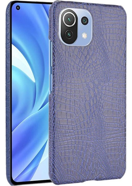 Xiaomi Mi 11 Lite Klasik Timsah Moda Kapak Için Şık Klasik Durumda (Yurt Dışından)