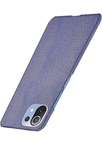Xiaomi Mi 11 Lite Klasik Timsah Moda Kapak Için Şık Klasik Durumda (Yurt Dışından) modelleri