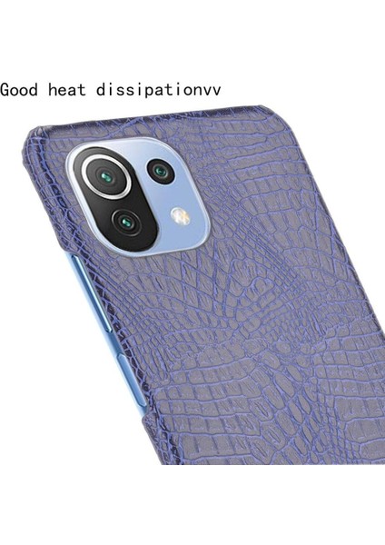 Xiaomi Mi 11 Lite Klasik Timsah Moda Kapak Için Şık Klasik Durumda (Yurt Dışından) indirimleri