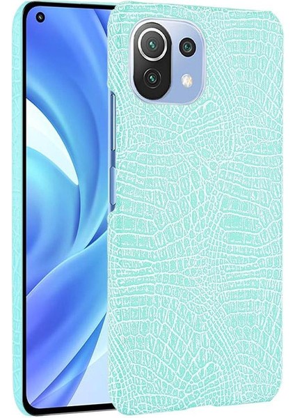 Xiaomi Mi 11 Lite Klasik Timsah Moda Kapak Için Şık Klasik Durumda (Yurt Dışından)