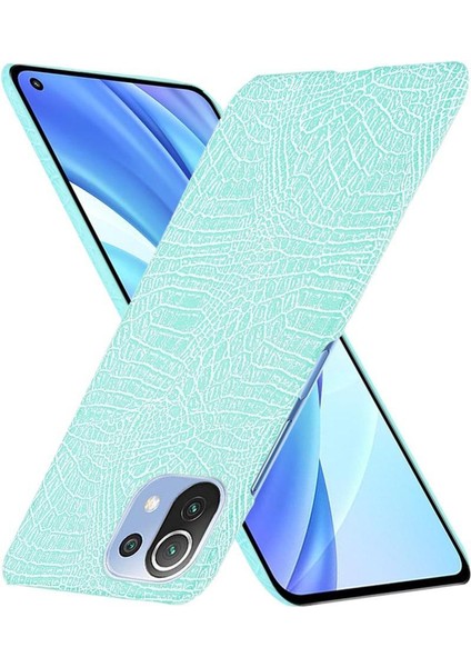 Xiaomi Mi 11 Lite Klasik Timsah Moda Kapak Için Şık Klasik Durumda (Yurt Dışından) fırsatları