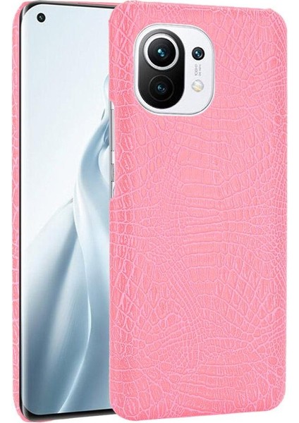 Xiaomi Mi 11 Klasik Timsah Moda Anti Kapak Için Şık Klasik Durumda (Yurt Dışından)
