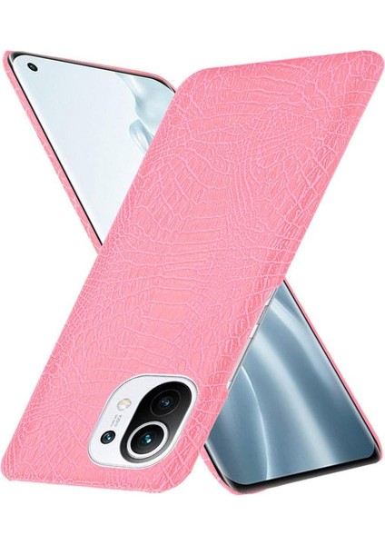 Xiaomi Mi 11 Klasik Timsah Moda Anti Kapak Için Şık Klasik Durumda (Yurt Dışından) fiyatları