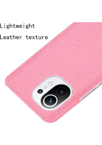 Xiaomi Mi 11 Klasik Timsah Moda Anti Kapak Için Şık Klasik Durumda (Yurt Dışından) modelleri