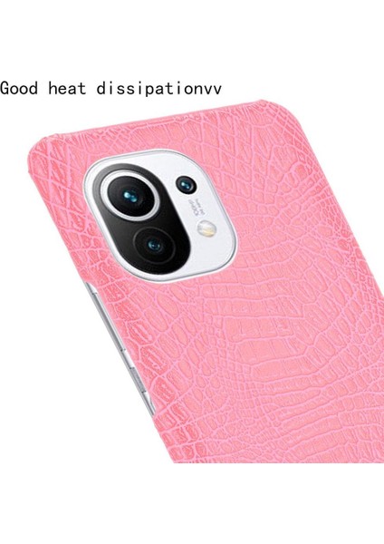 Xiaomi Mi 11 Klasik Timsah Moda Anti Kapak Için Şık Klasik Durumda (Yurt Dışından) indirimleri