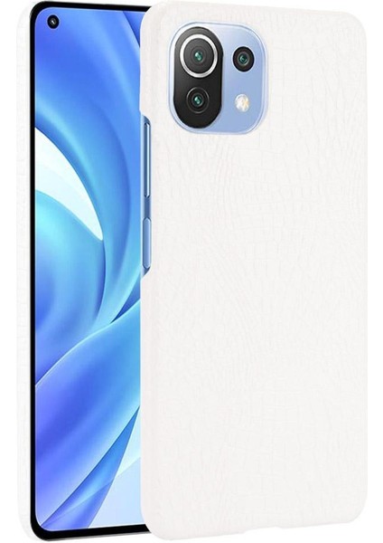 Xiaomi Mi 11 Lite Klasik Timsah Moda Kapak Için Şık Klasik Durumda (Yurt Dışından)