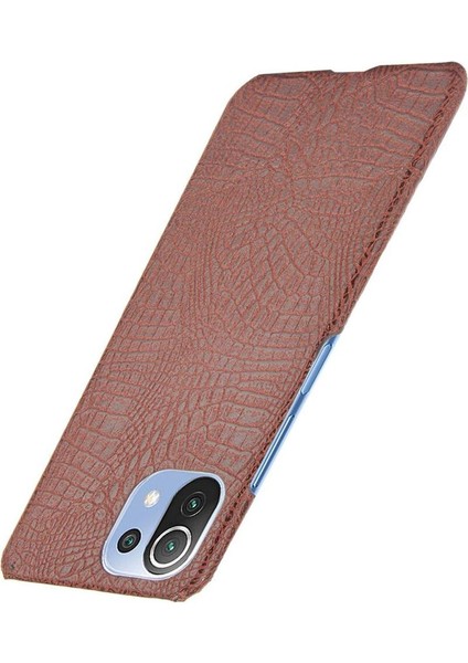 Xiaomi Mi 11 Lite Klasik Timsah Moda Kapak Için Şık Klasik Durumda (Yurt Dışından) fiyatları