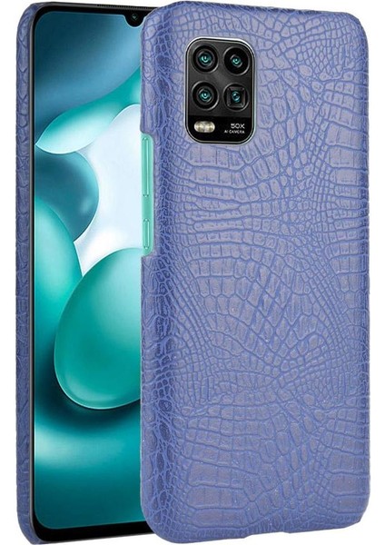 Xiaomi Mi 10 Lite 5g Için Şık Klasik Durumda Klasik Timsah Moda (Yurt Dışından)