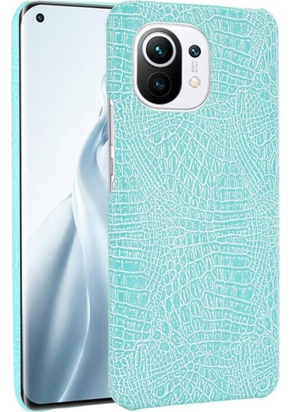 Xiaomi Mi 11 Klasik Timsah Moda Anti Kapak Için Şık Klasik Durumda (Yurt Dışından)
