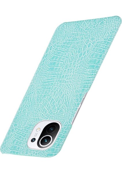 Xiaomi Mi 11 Klasik Timsah Moda Anti Kapak Için Şık Klasik Durumda (Yurt Dışından) fırsatları