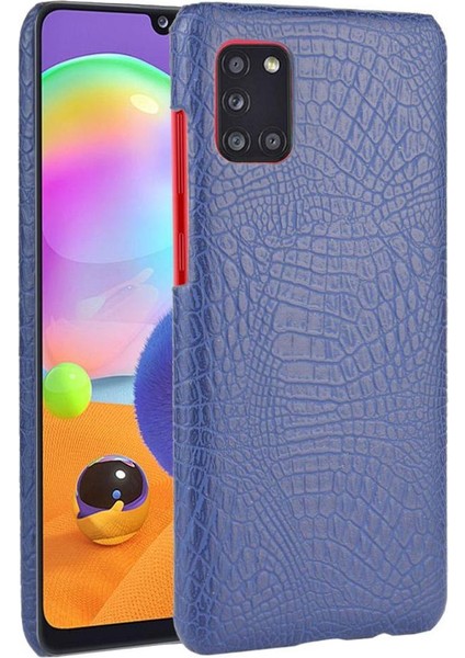 Samsung Galaxy Stylish Klasik Timsah Moda Anti Için Şık Klasik Kılıf (Yurt Dışından)